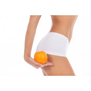 Appelsinhud og Cellulitis