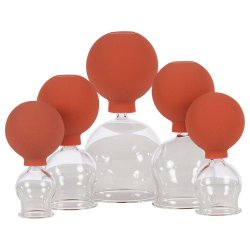 Sport-tec Cupping-st i glas til professionelt brug m. 5 strrelser - Fra  2,5 til 6,5 cm.