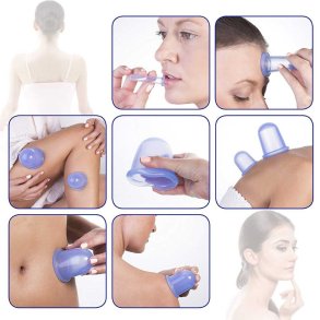 Cupping