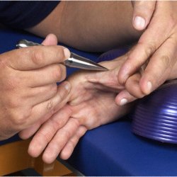 Reha Pointer Deluxe Massagestave i metal - 2 stk.