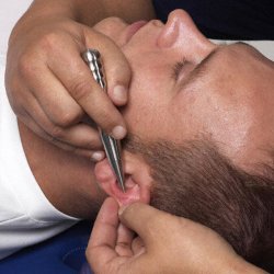 Reha Pointer Deluxe Massagestave i metal - 2 stk.