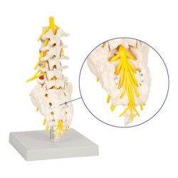 Lndehvirvelsjle inkl. stativ