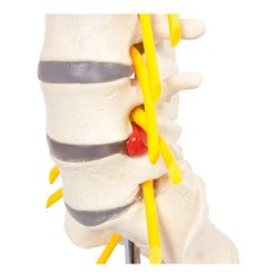 Lndehvirvelsjle inkl. stativ