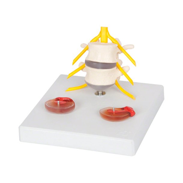 Diskusmodel med 2 lndehvirvler - 19x19x19 cm.