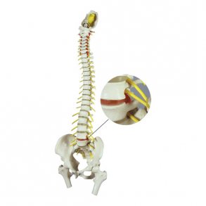 Rygsjle med diskusprolaps - Inkl. stativ - 80 cm.