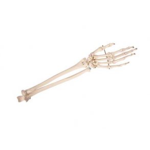 Anatomisk skelet af hnd m. underarm