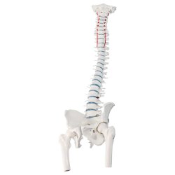Anatomisk skelet af rygs�jle m. diskusprolaps inkl. stativ