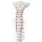 Anatomisk skelet af rygs�jle m. diskusprolaps inkl. stativ